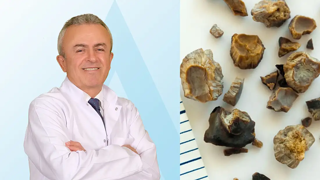 Yetersiz su tüketimi böbrek taşına yol açabiliyor