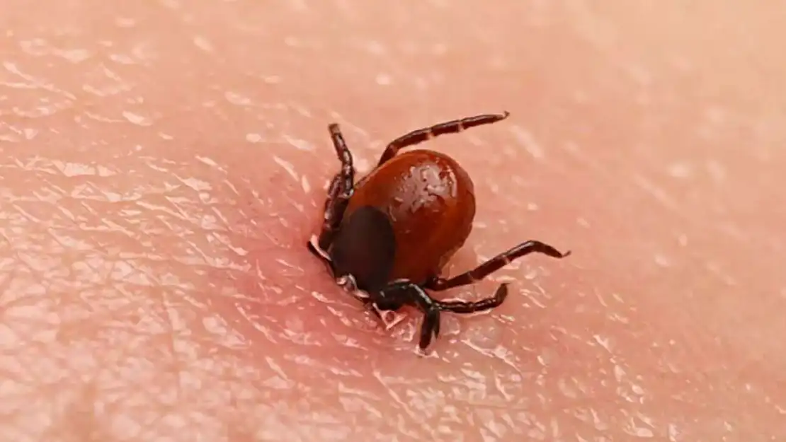 55 Yaşındaki Vatandaş Keneyi Kendi Çıkardı  Hayatını Kaybetti