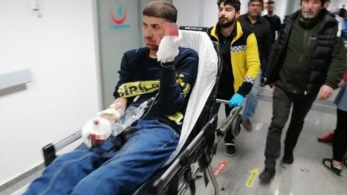 Elinde havai fişek patladı