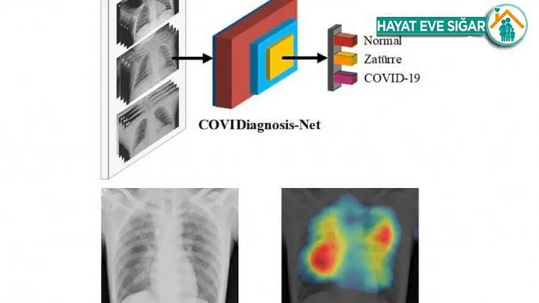 Korona virüs teşhisini kolaylaştıracak yapay zeka sistemi