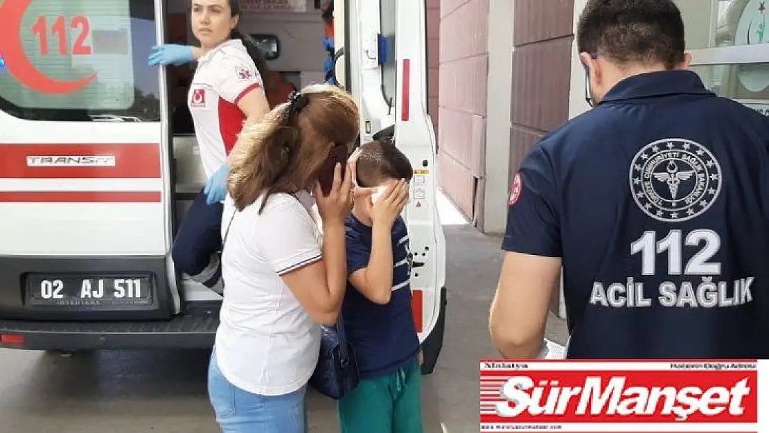 Küçük çocuğun yüzünde maytap patladı
