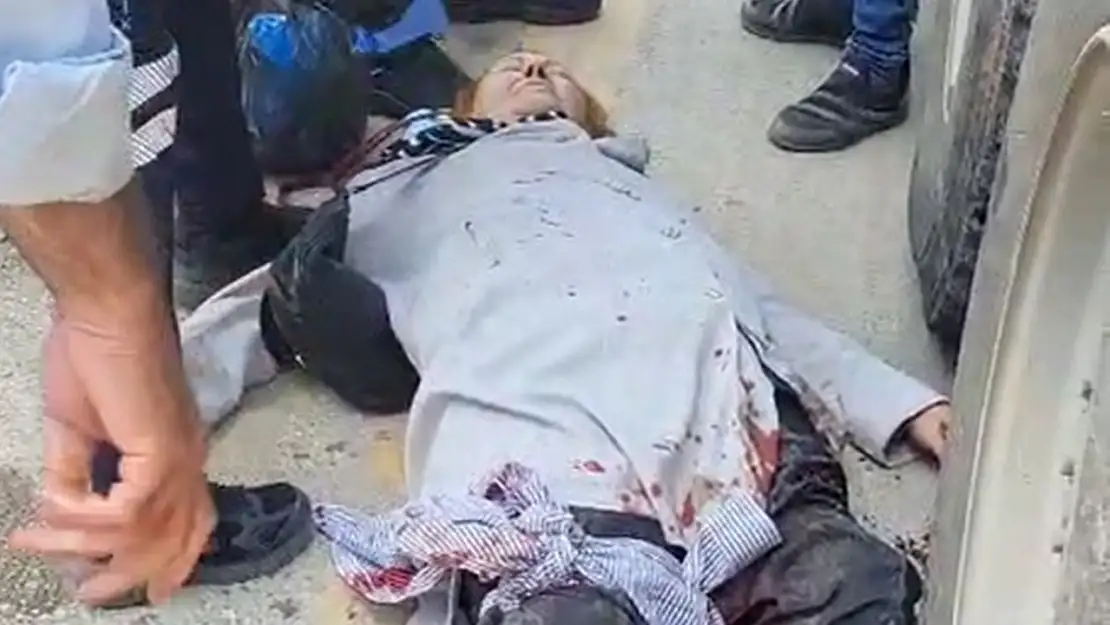 Yolun Karşısına Geçmeye Çalışıyordu… Kamyon Çarptı Ağır Yaralandı!