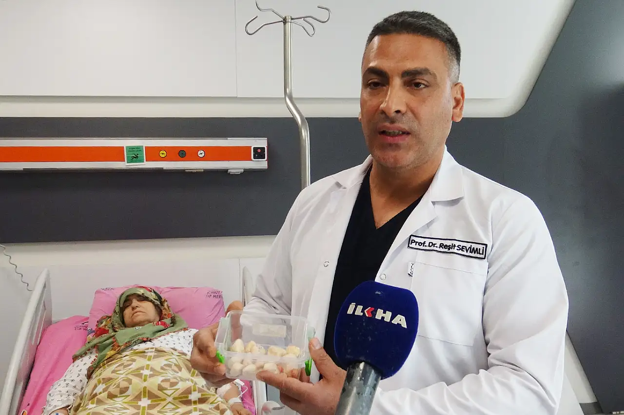 Malatya'da 73 yaşındaki kadının dizinden 24 taşlaşmış tümör çıkarıldı!