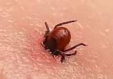 55 Yaşındaki Vatandaş Keneyi Kendi Çıkardı Hayatını Kaybetti