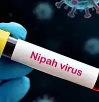 Yüzde 75 Ölüm Oranı! Nipah Virüsü Korkutuyor