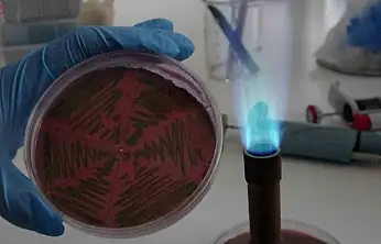 Çiğ süt, gıdayla bulaşan idrar yolu enfeksiyonlarına kapı açıyor