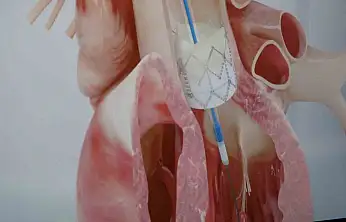 Prof. Dr. Pekdemir: 'Gençlerde ani ölümlerin yüzde 90'ı genetik nedenlerden kaynaklanıyor'