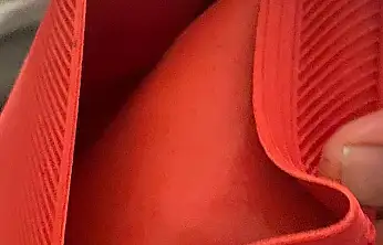 Su torbası faciası, genç kızın vücudunun yüzde 25'i yandı