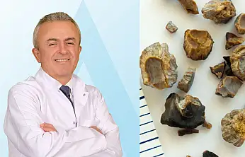 Yetersiz su tüketimi böbrek taşına yol açabiliyor