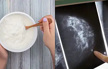 Yoğurt tüketimi meme kanserine karşı koruyucu olabilir mi?