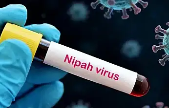 Yüzde 75 Ölüm Oranı! Nipah Virüsü Korkutuyor