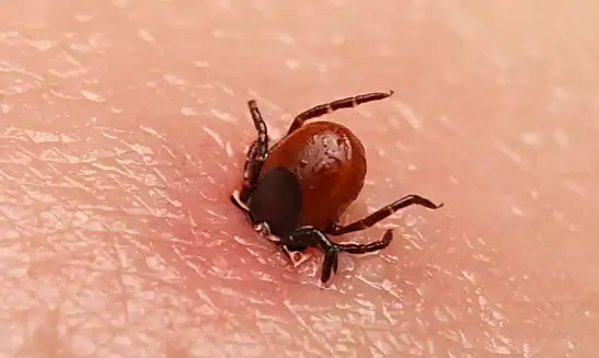55 Yaşındaki Vatandaş Keneyi Kendi Çıkardı Hayatını Kaybetti