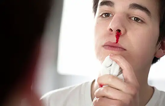 Sıcak Havalarda Burun Kanaması Neden Artıyor?