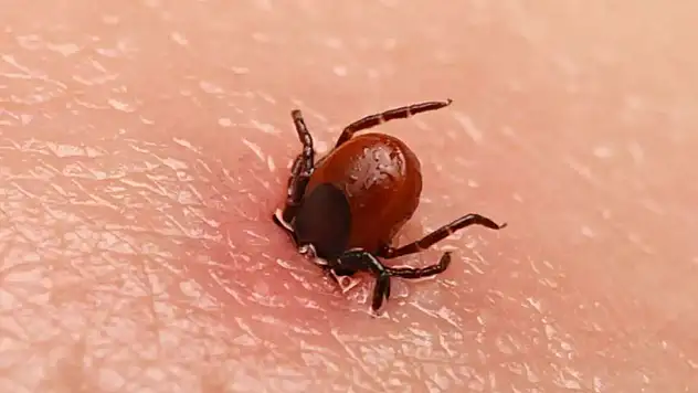 55 Yaşındaki Vatandaş Keneyi Kendi Çıkardı Hayatını Kaybetti