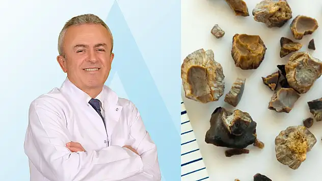 Yetersiz su tüketimi böbrek taşına yol açabiliyor