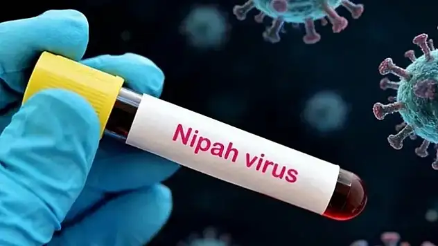 Yüzde 75 Ölüm Oranı! Nipah Virüsü Korkutuyor