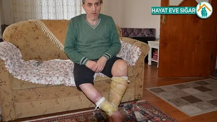 Ayak ülseri hayatını kararttı, evden dışarı çıkamıyor