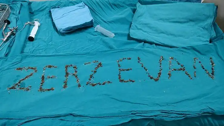 Böbreğinden 'Zerzevan' çıktı