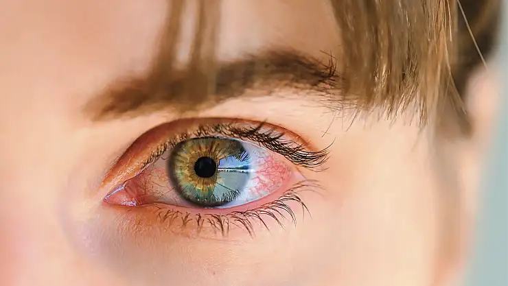 Göz muayenesi hayat kurtarabilir!