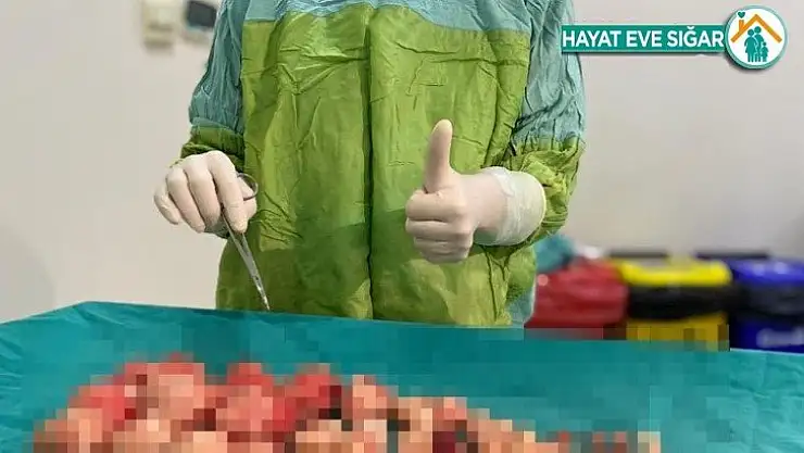 Karın ağrısı yaşayan hastanın rahminden 72 miyom çıkarıldı