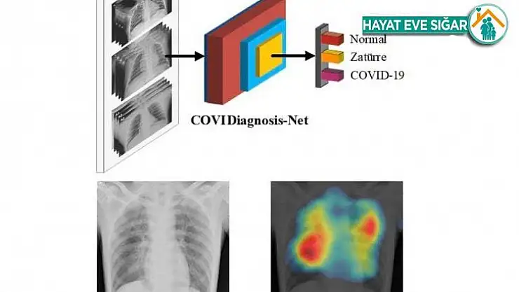 Korona virüs teşhisini kolaylaştıracak yapay zeka sistemi