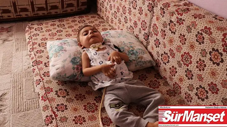 Küçücük bedeni ile yaşam savaşı veriyor