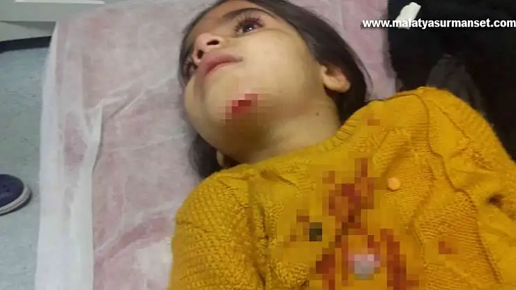 Rögar kapağı açık bırakıldı, 7 yaşındaki çocuk belediyenin çukuruna düştü