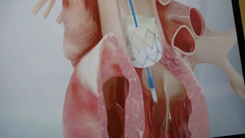 Prof. Dr. Pekdemir: 'Gençlerde ani ölümlerin yüzde 90'ı genetik nedenlerden kaynaklanıyor'