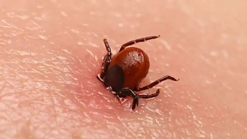 55 Yaşındaki Vatandaş Keneyi Kendi Çıkardı Hayatını Kaybetti