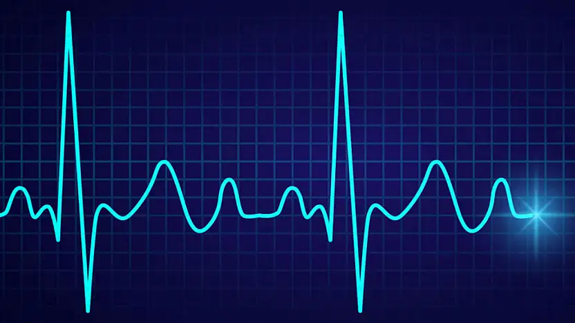 Ritim Bozukluğunda 15 Yıllık Arayış Sonuç Verdi