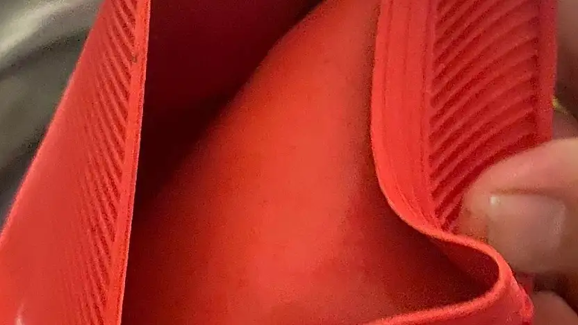 Su torbası faciası, genç kızın vücudunun yüzde 25'i yandı