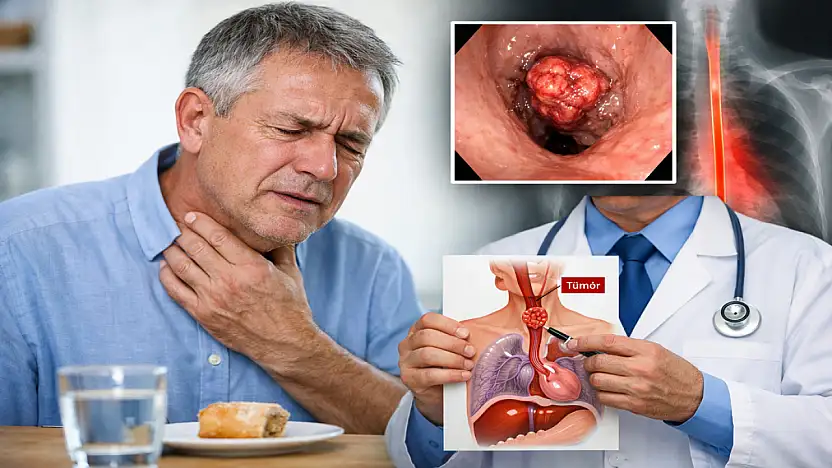 Yemek borusu kanserinin 6 belirtisine dikkat