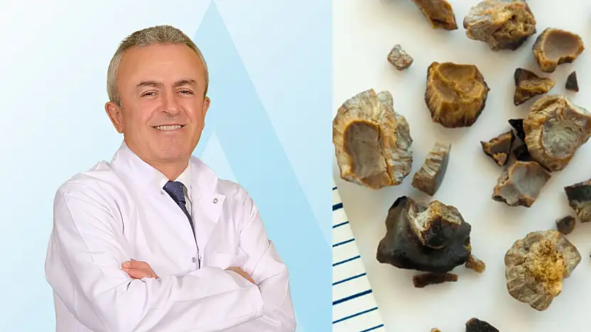 Yetersiz su tüketimi böbrek taşına yol açabiliyor