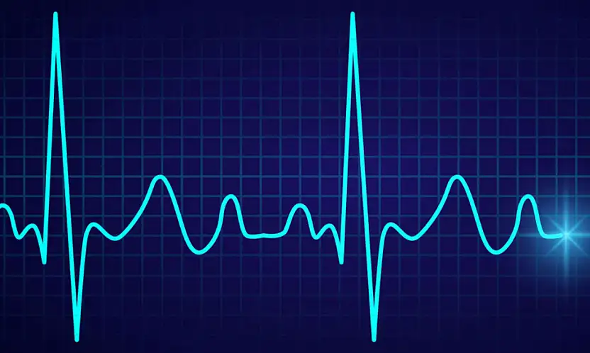 Ritim Bozukluğunda 15 Yıllık Arayış Sonuç Verdi