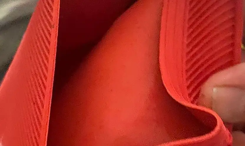 Su torbası faciası, genç kızın vücudunun yüzde 25'i yandı