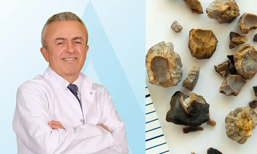 Yetersiz su tüketimi böbrek taşına yol açabiliyor