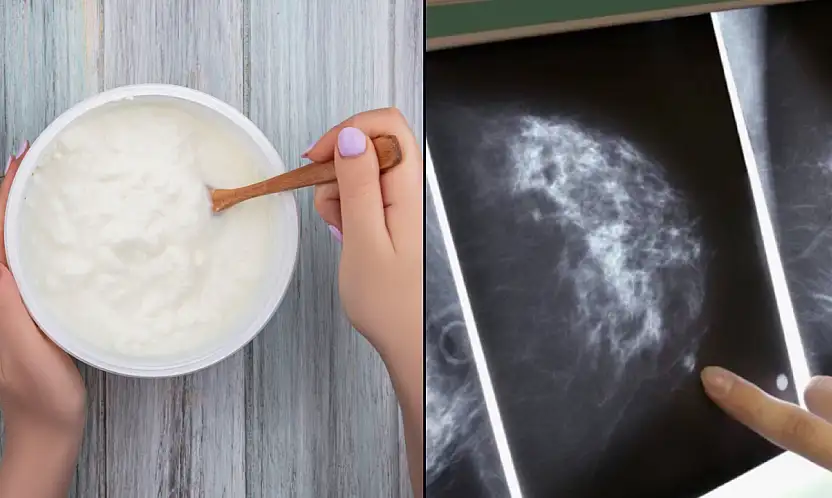 Yoğurt tüketimi meme kanserine karşı koruyucu olabilir mi?